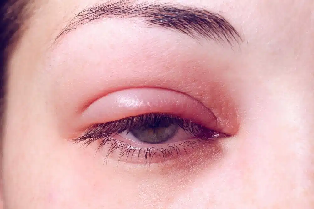 The Risks of DIY Eyelash Extensions diy eyelash extensions lash extensions at home how to do lashes on yourself