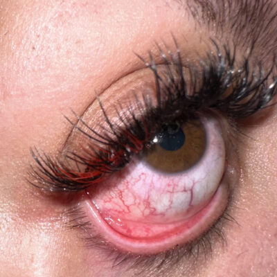red eyes after-lash-extnsions