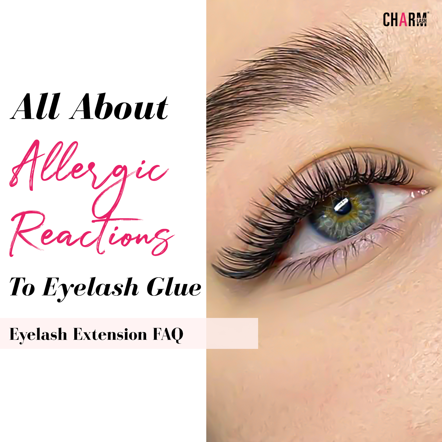 All about allergy to lash glue