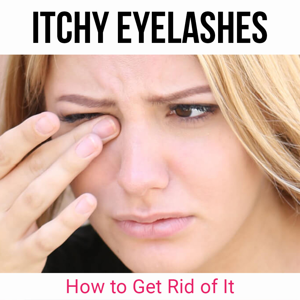 Itchy Eyelashes - How to get rid of it