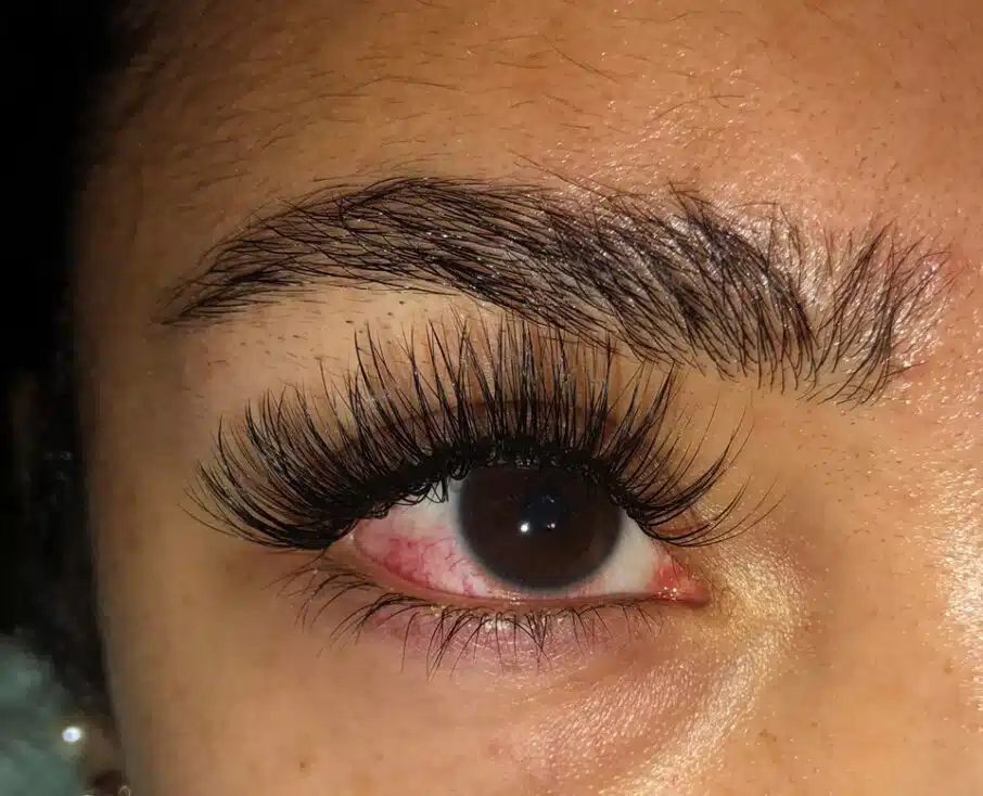 After you get itchy eyelashes