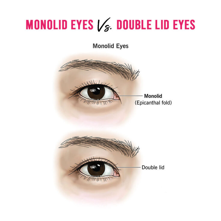 Monolid Eyes vs Double Eyelid Eyes