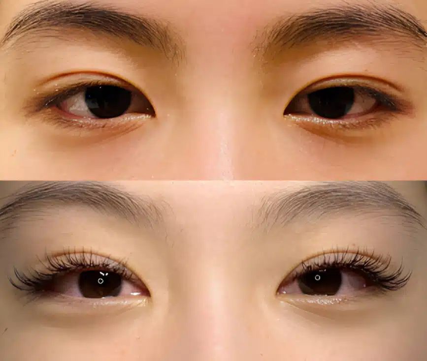 Eyelash Extensions on Straight Lashes: Pro Tips and Techniques for Lash Artists Eyelash Extensions on Straight Lashes before and after