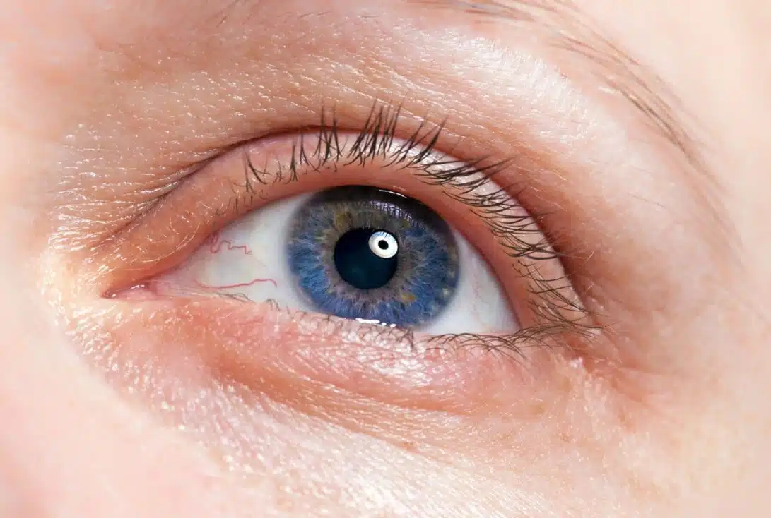 6 proven ways to achieve longer and thicker eyelashes Thin lashes