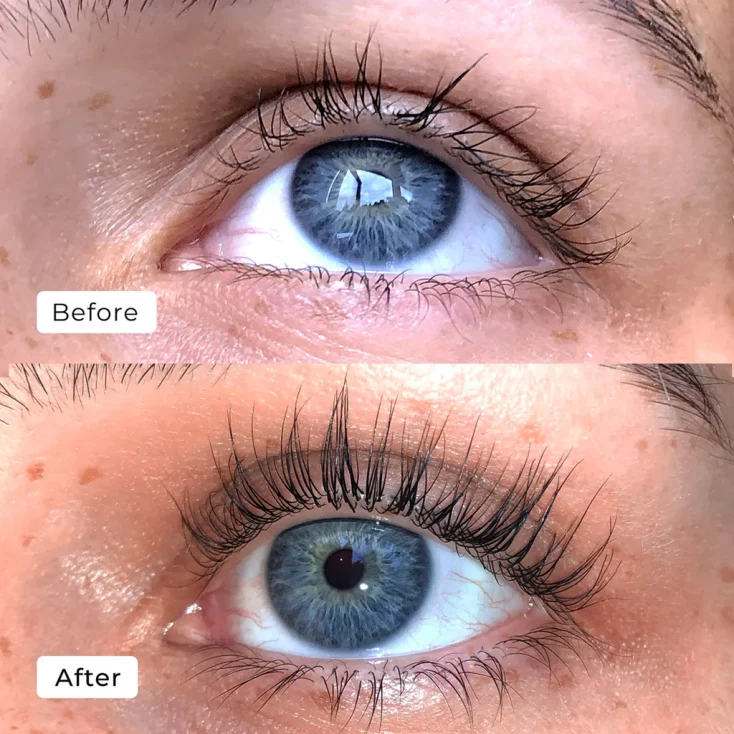 Can you use lash serum with lash extensions? Expert tips & Insights What is lash serum