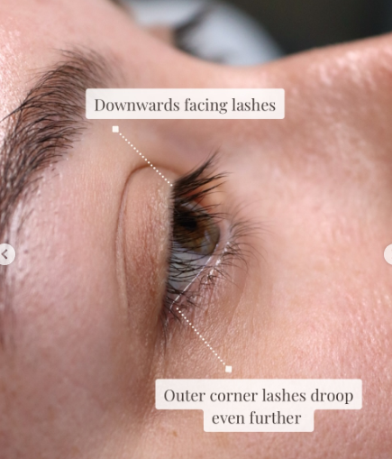 Downward-lashes